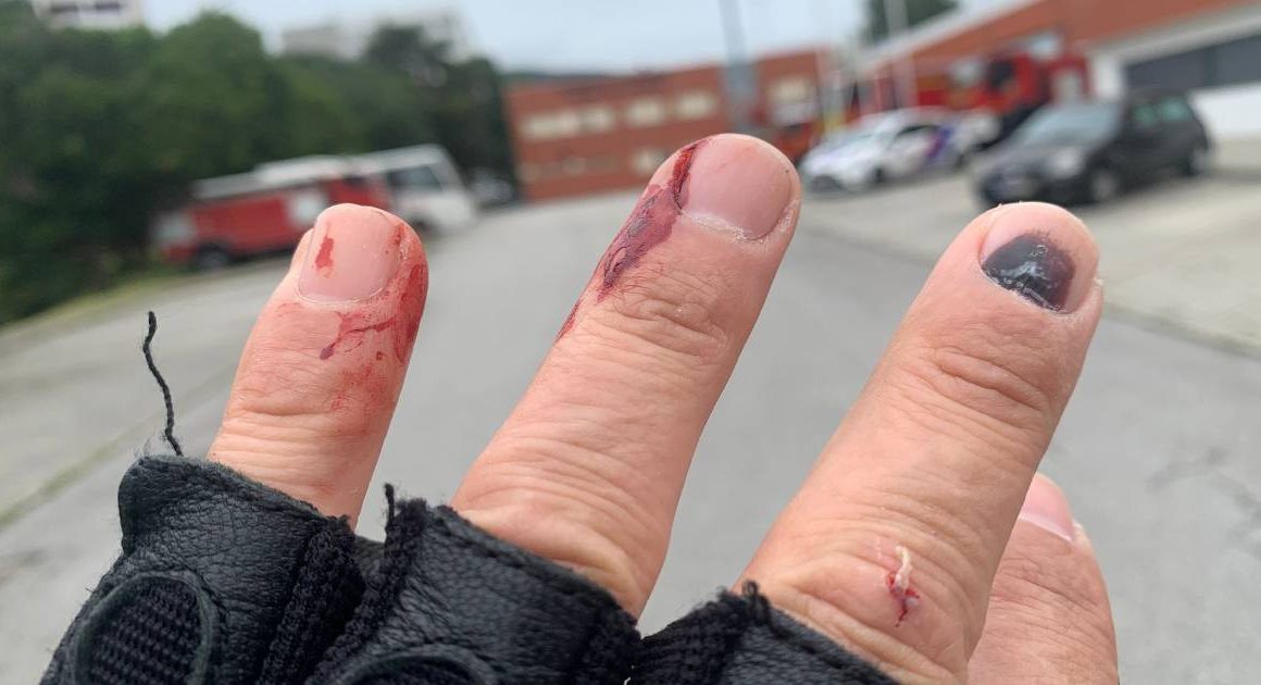 Queixa-se de ter sido agredido por bombeiros sapadores em viana